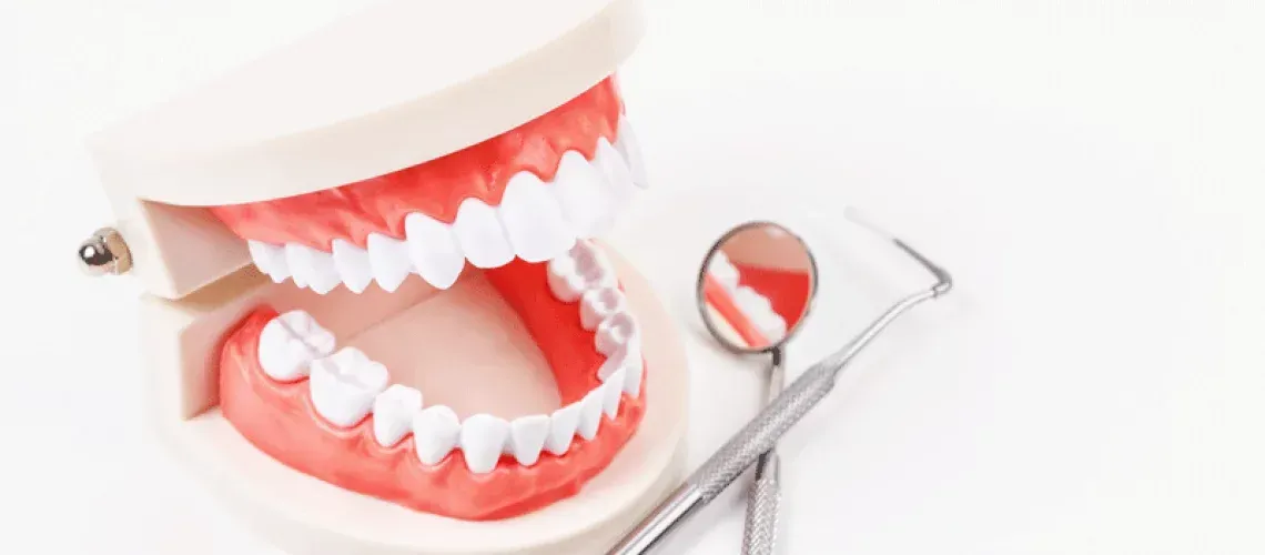 Dental Implant Process Help