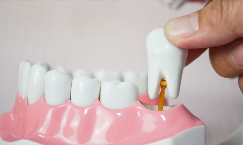 A hand extracts a molar tooth from a dental model, illustrating the tooth removal process with white teeth embedded in pink gum tissue.