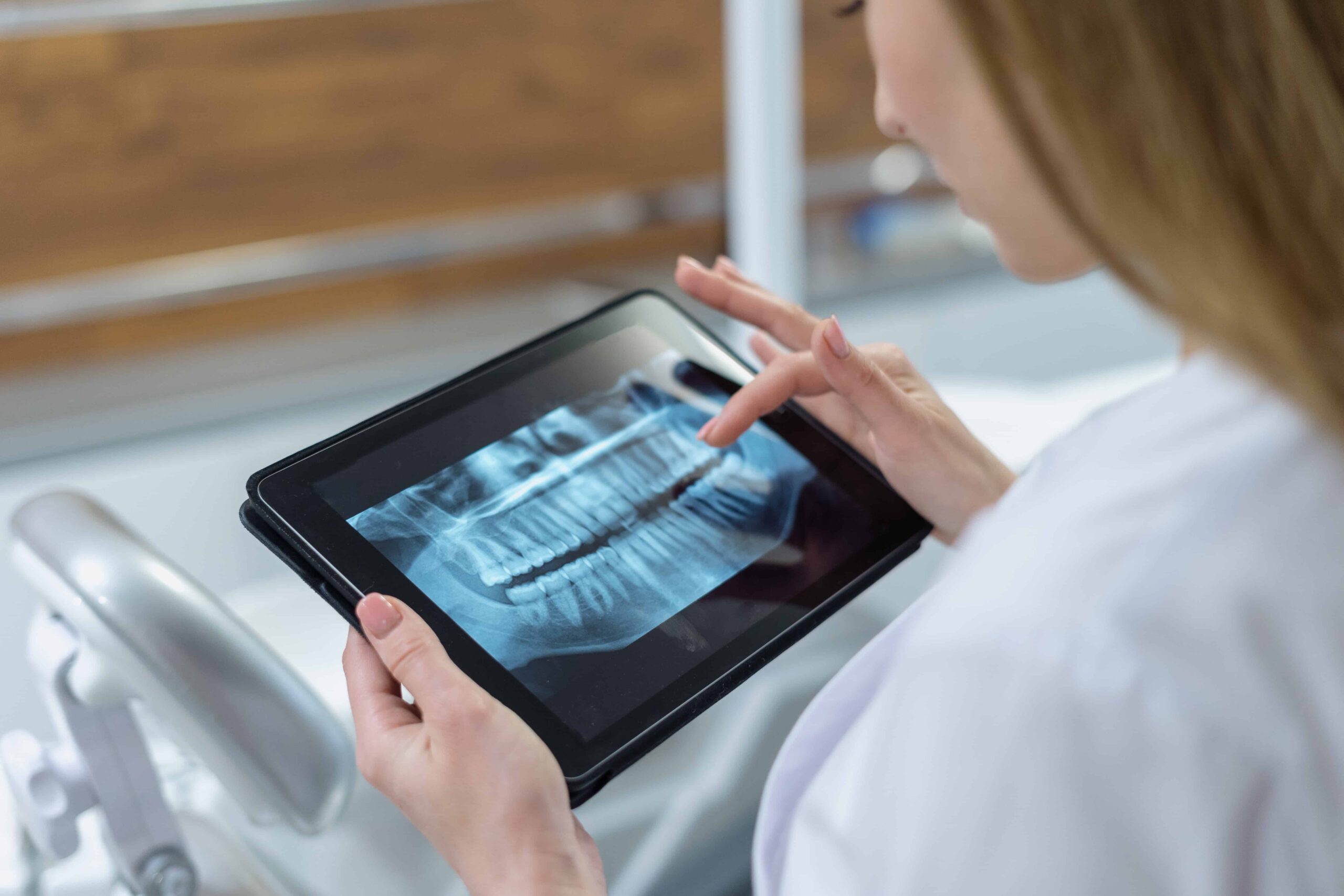 Dental-Implants Service Banner Image