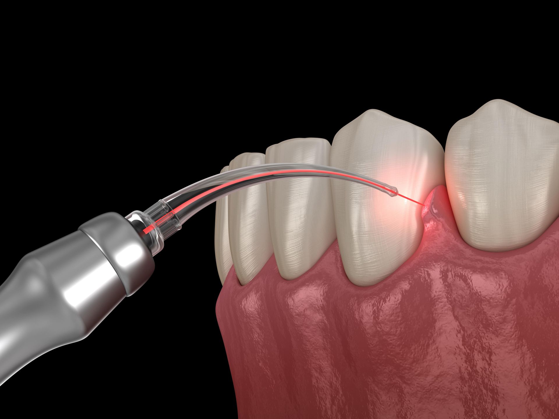 Soft Tissue Treatment Banner Image