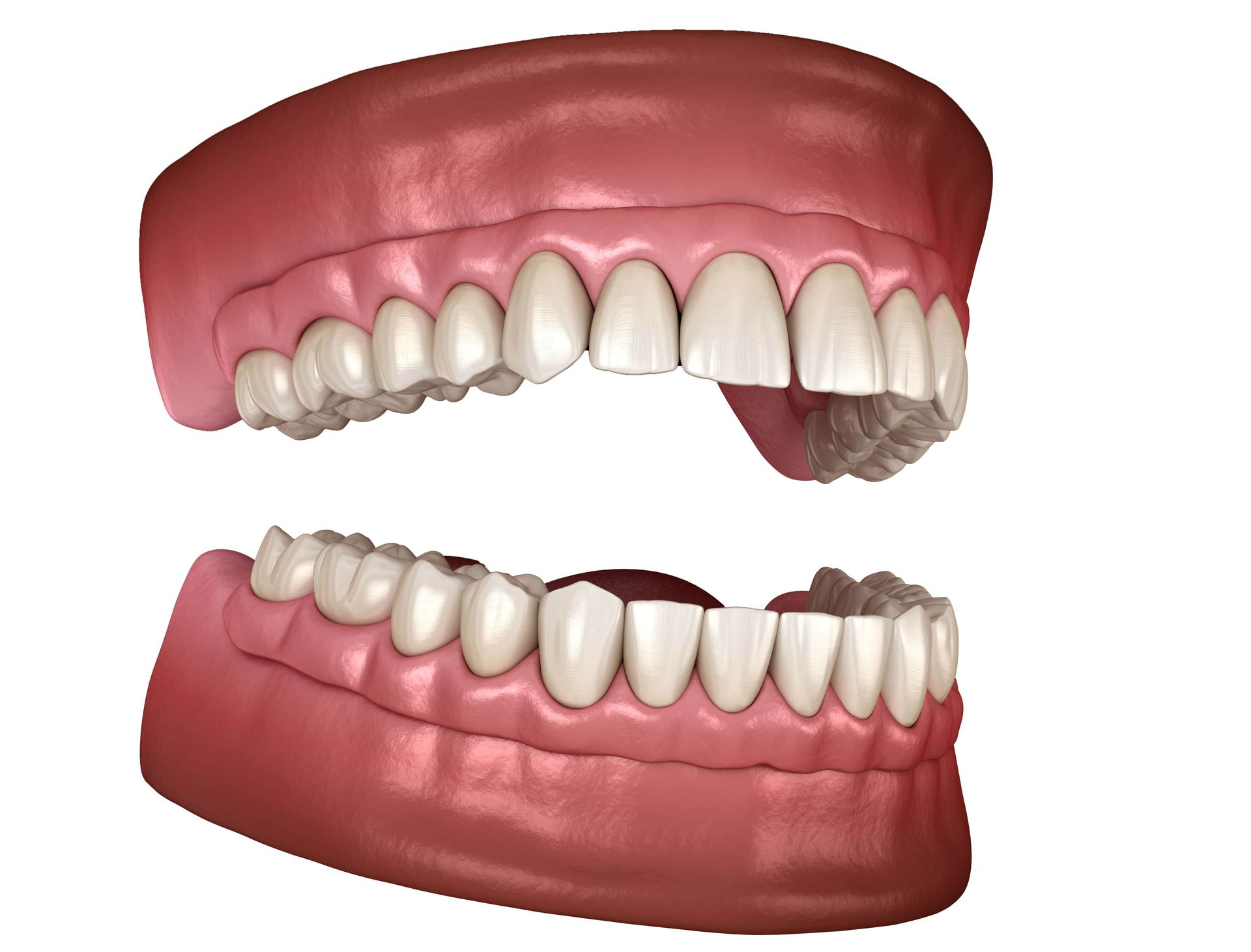 TeethXpress