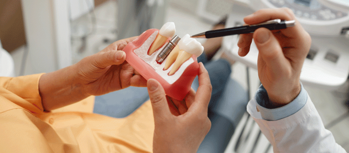 Dental Implants Procedure Animation