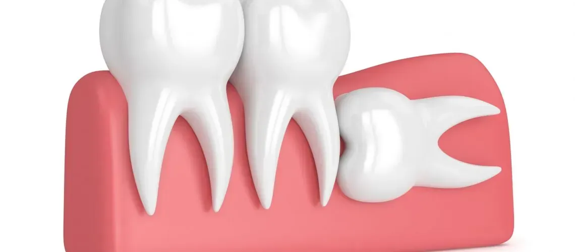 Patient with Dental Implant Consultation