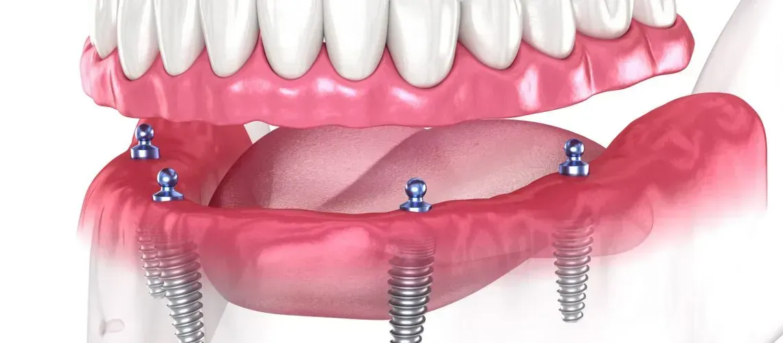 Close-Up of Smiling Patient