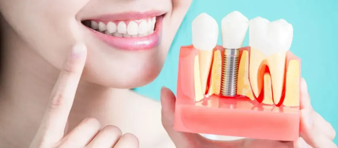 Happy Implant Patients