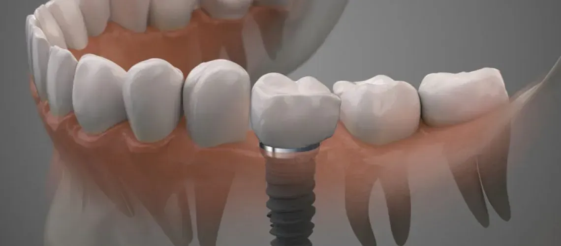 Patient Consulting Dentist