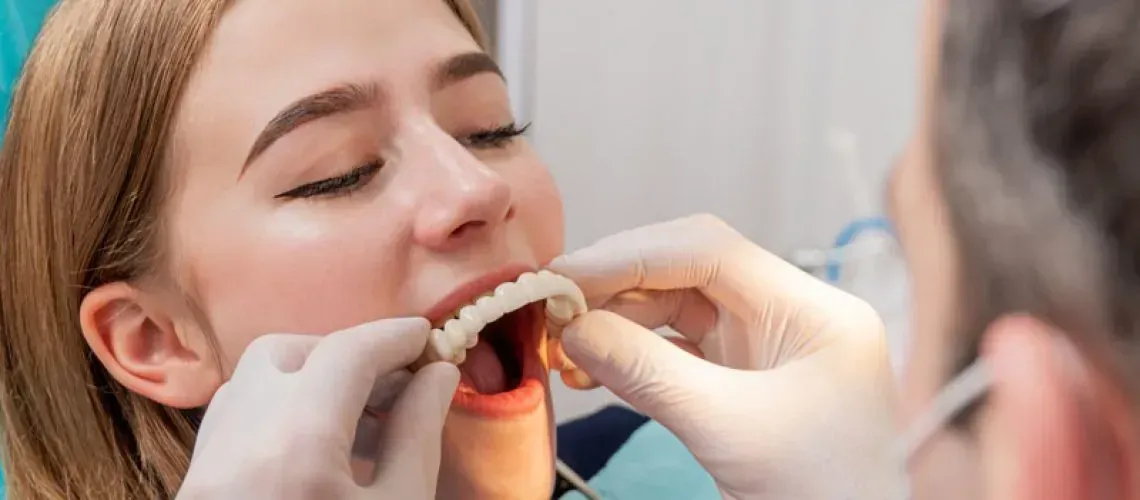 Stable Implant-Supported Dentures