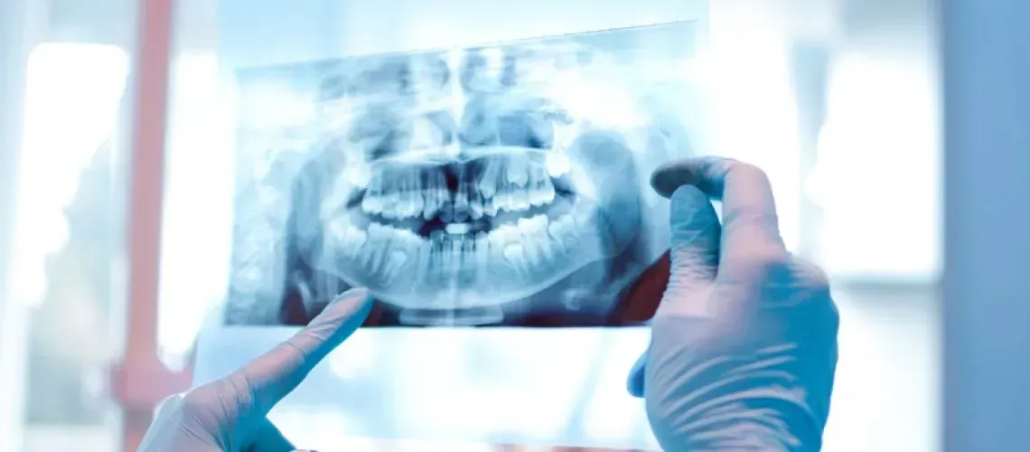 Oral Surgeon Explaining Procedure