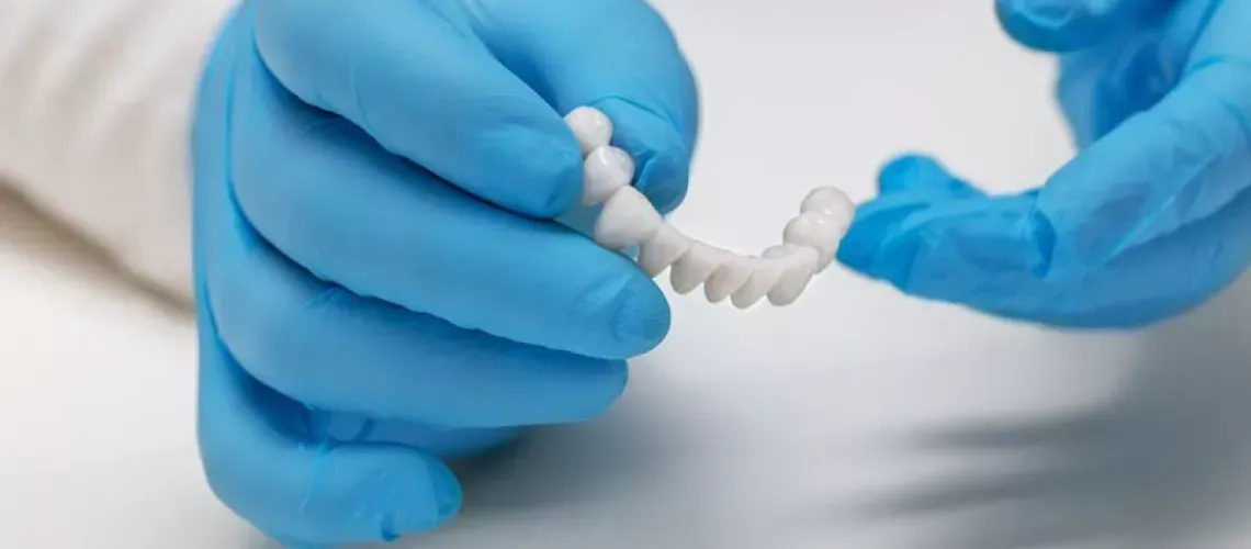Bone Grafting Implant Help