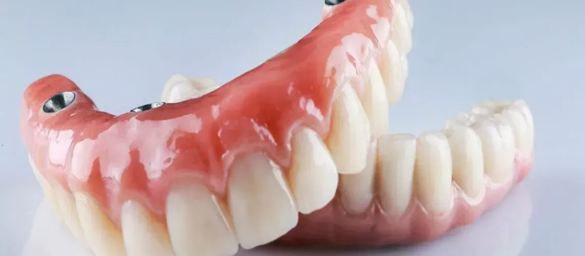 Teethxpress Treatment Benefits