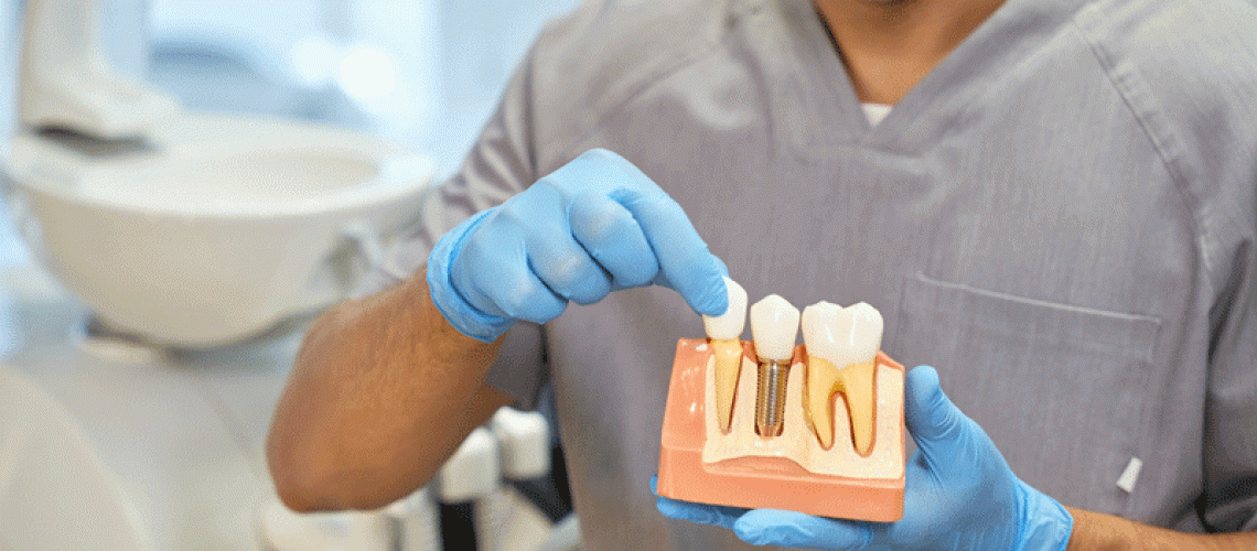 Dental Implants Explainer Animation