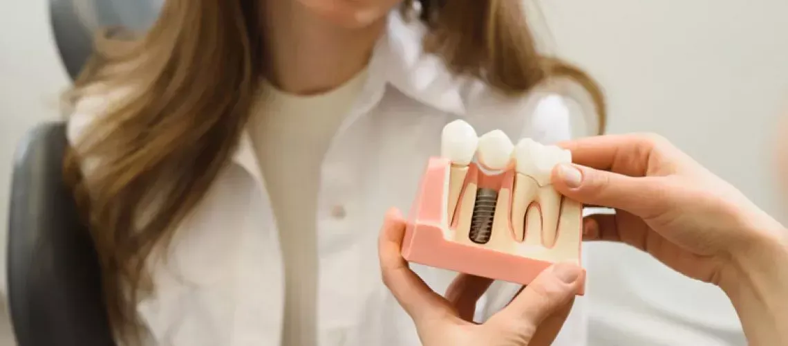 How Many Days Does It Take To Implant A Tooth?